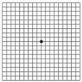 Normal Amsler Grid