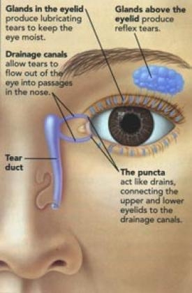 Dry Eye